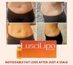 Lusci Lipo - Image 3